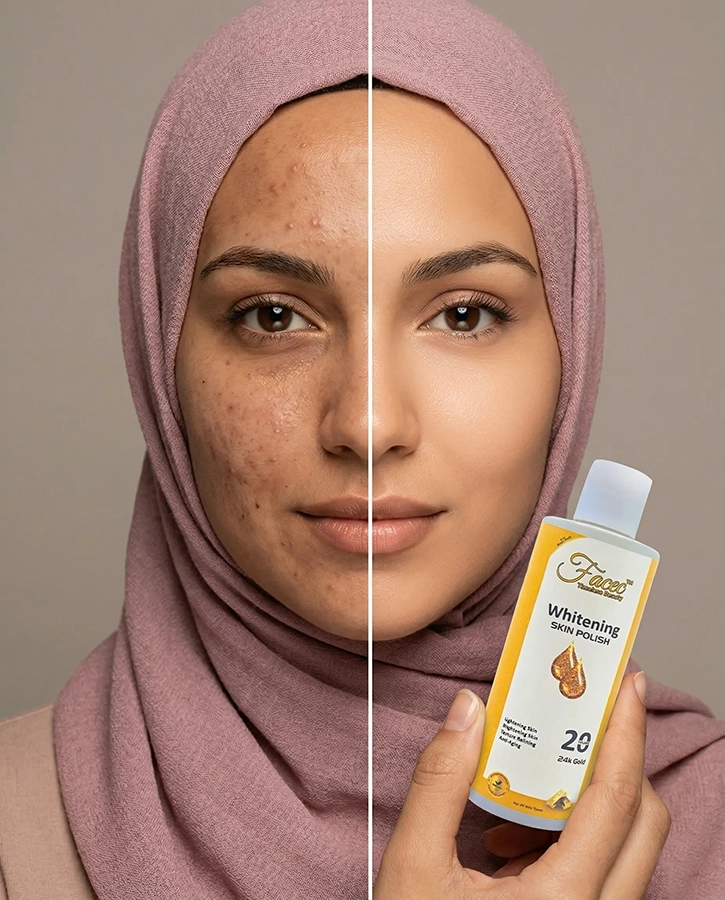 gold skin polish model